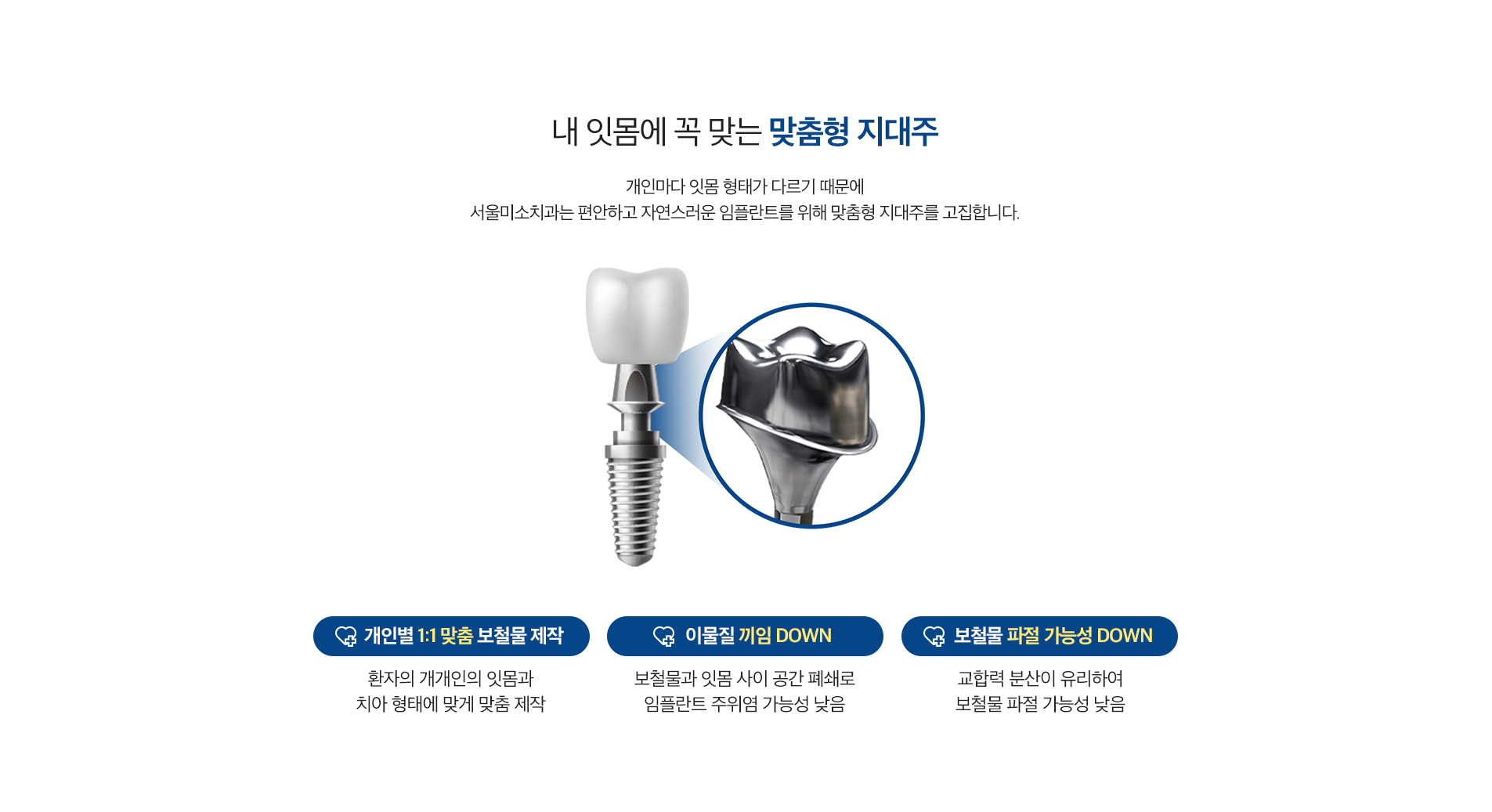 맞춤형 지대주