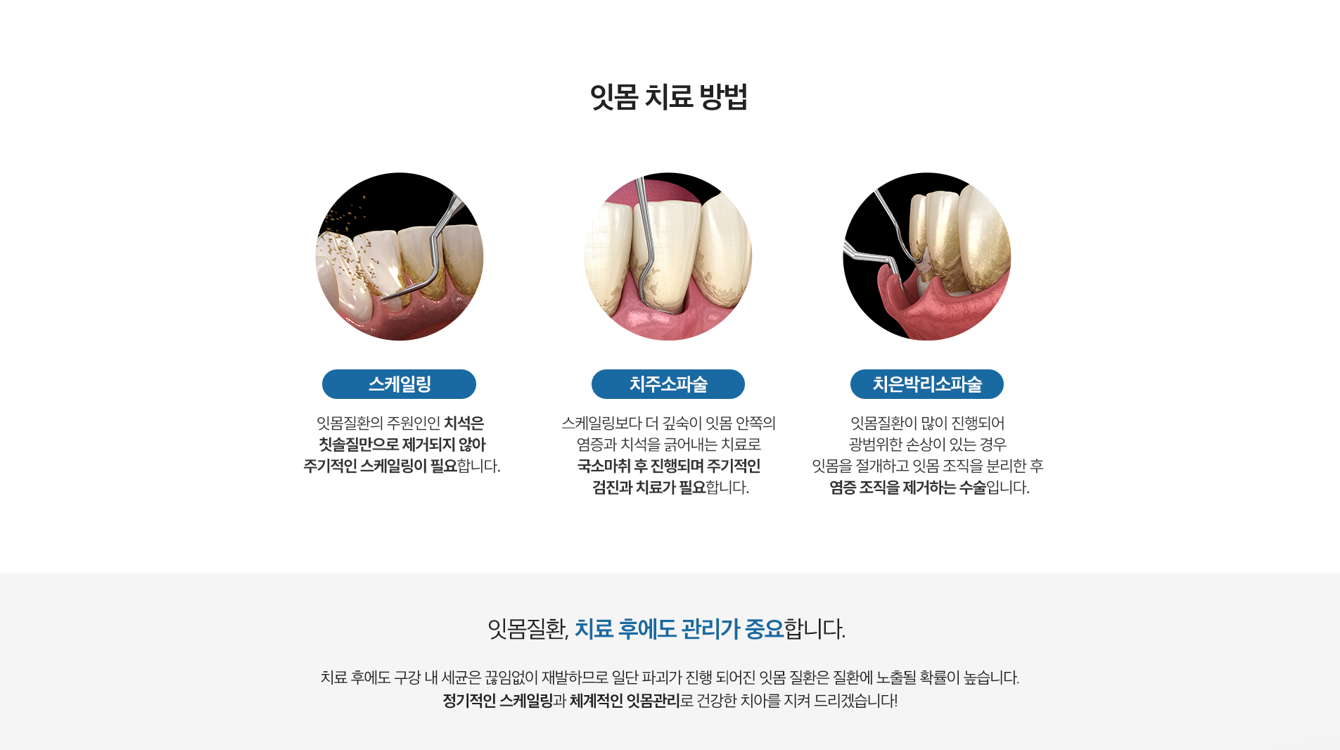 잇몸 치료 방법