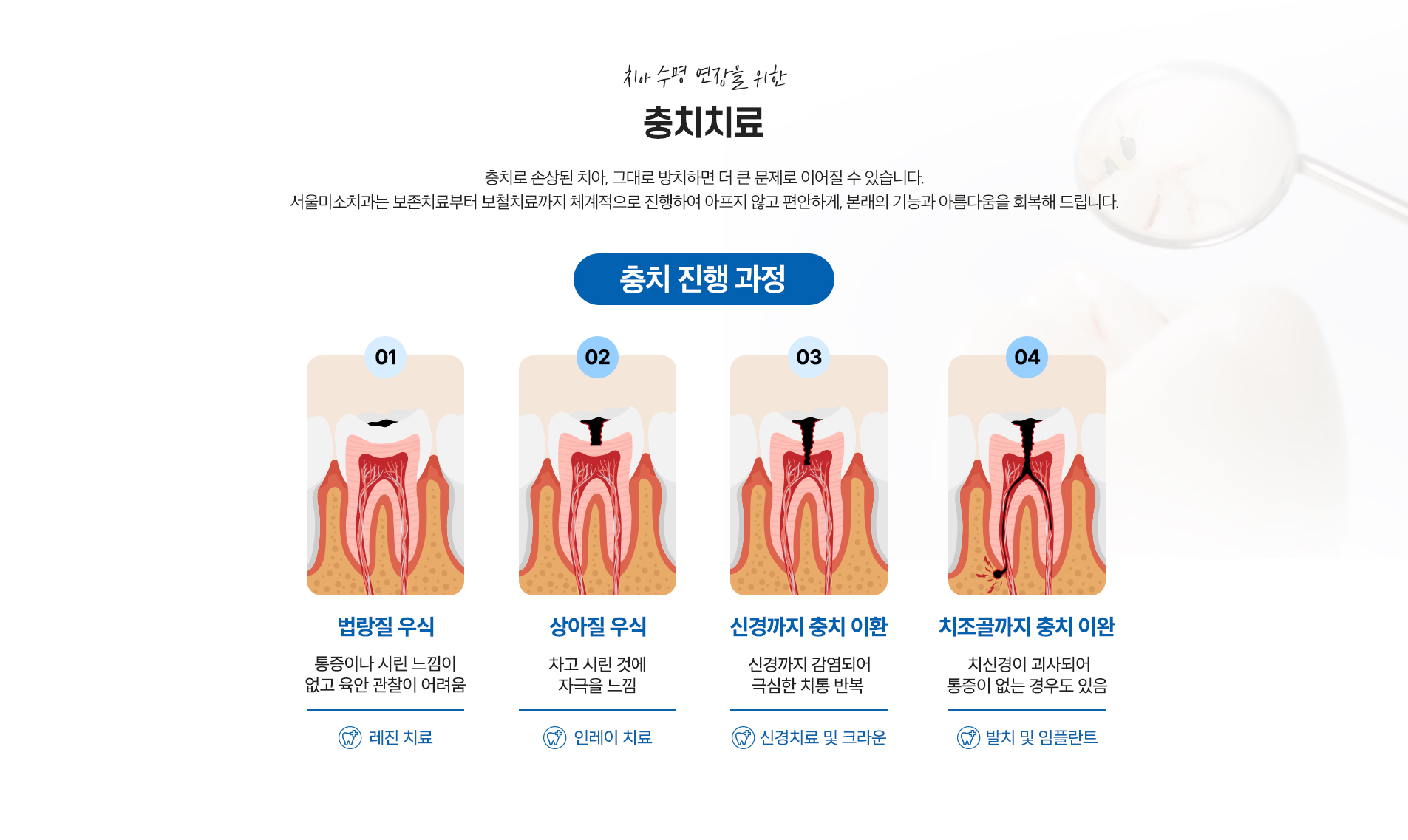 충치치료