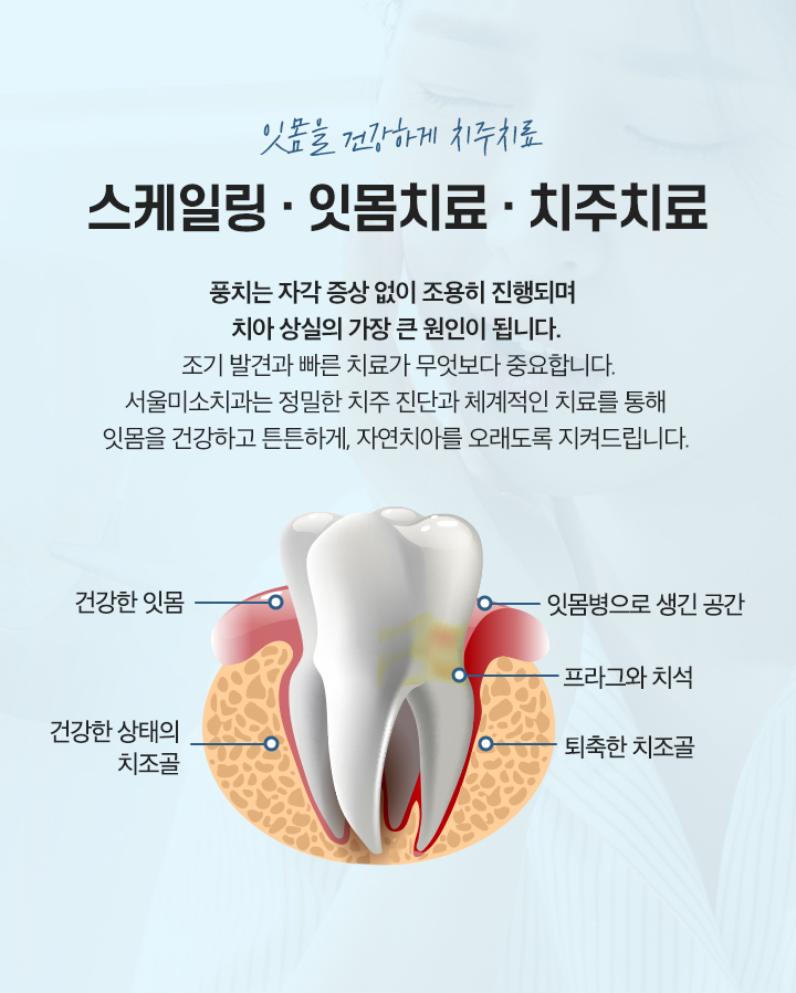 스케일링/잇몸치료/치주치료